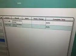 Table showing amounts of IgG and IgM antibodies detected in sample
