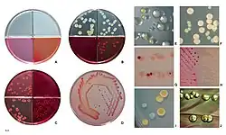 E. coli colonies