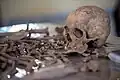 Exhumed skeletal remains of victims of the Isaaq genocide found from a mass grave site located in Berbera, Somaliland.