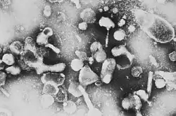 Electron micrograph of Feline leukemia virus