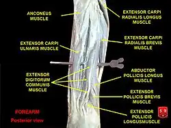 Extensor carpi radialis brevis muscle