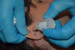 a photo of a medical professional administering ear drops