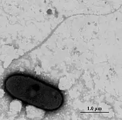 Microscope image depicting the bacterium Massilia putida, which appears as a black irregular round shape on a light grey-white background