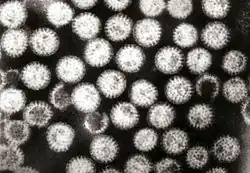 Transmission electron micrograph of rotavirus virions