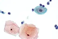 Very high magnification view