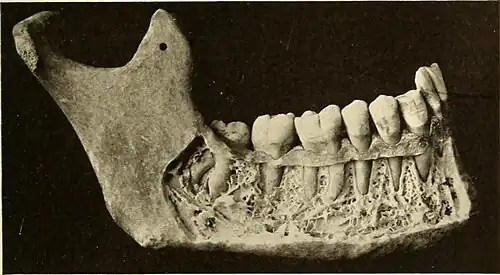 Cutaway view showing spongy bone