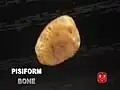 Pisiform bone.