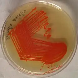 Serratia marcescens: red pigmentation: although considered characteristic of the species, only about 10% of specimens produce this pigment: 236 