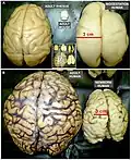 Various brains. Clockwise from top left: Adult rhesus; Adult mouse; Midgestation human; Newborn human; Adult human.