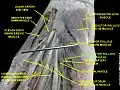 Adductor pollicis muscle