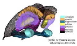 Figure showing triangualted meshes generated from populations of many segmented MRI brains. Each different surface represents a different shape in shape space.