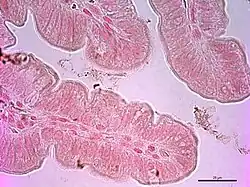 Microvellosidades intestinales del íleon.