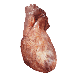 Corazón humano en movimiento. Es visible el inicio de la arteria aorta y de la arteria pulmonar