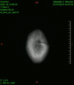 Animación en el plano axial