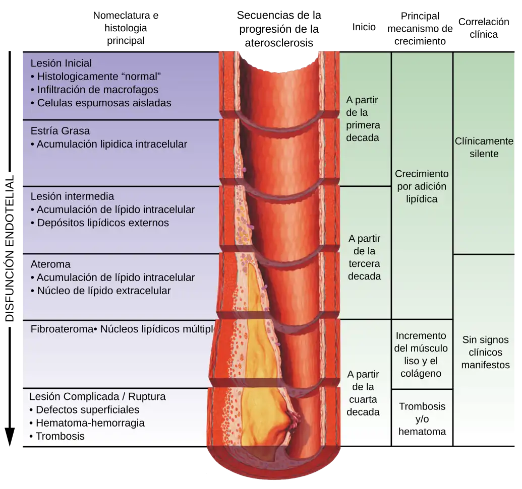 Atherosclerosis timeline - endothelial dysfunction-esp v1.1