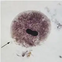 Un "quiste" de Balantidium coli