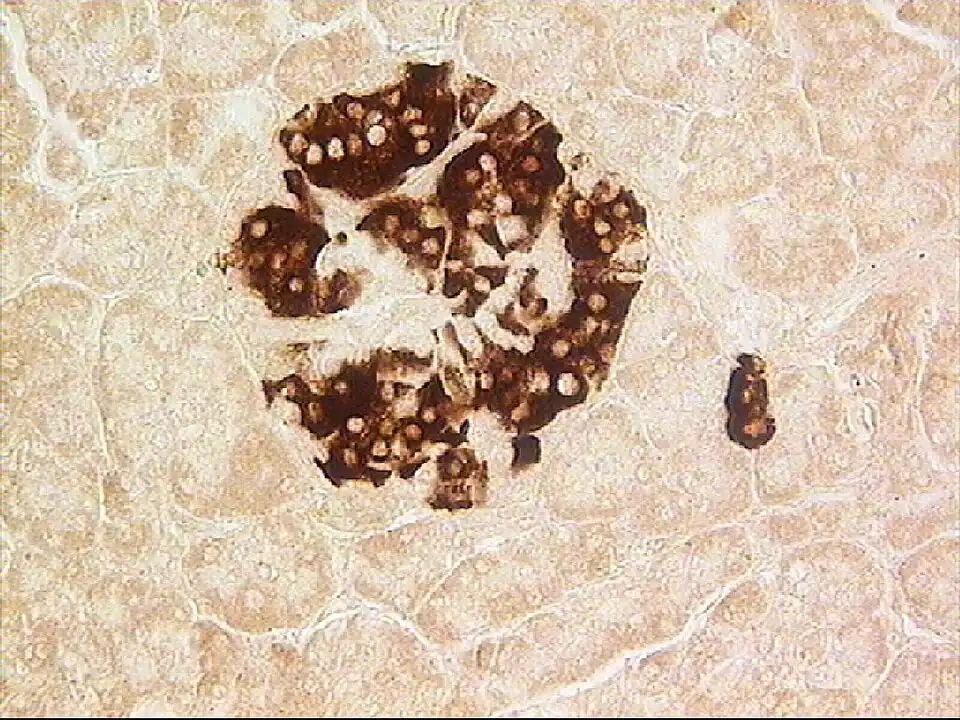 Células beta (β), citoplasma teñido mediante inmunohistoquímica de anticuerpos anti insulina. Microscopio óptico