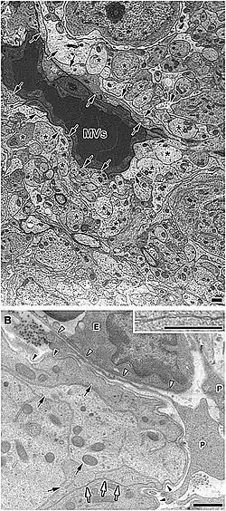 MVs= microvaso. Procesos celulares de las NSC (flechas sólidas). Asteriscos: dendritas similares a astrocitos/tanicitos. Microscopio electrónico