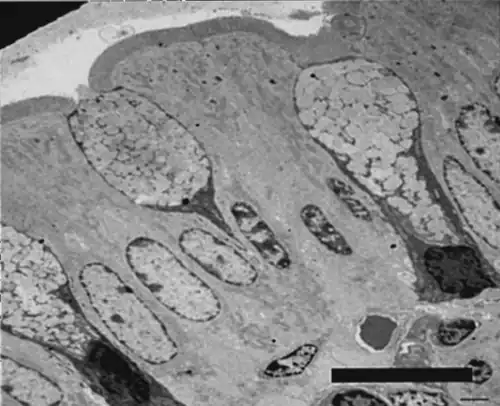Caliciforme con dominio basal ocupado por citoplasma periférico denso (gris oscuro) y por el núcleo celular (esferoide oscuro) abajo. Microscopio electrónico de transmisión