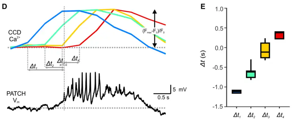 Una oscilación aislada del potencial de membrana (abajo, en negro): despolarización, meseta y espigas. Vm= voltaje de membrana; mV= milivoltios; s= segundos. Barra de escala de tiempo= 0,5 segundo. Barra de escala de voltaje= 5mV.
