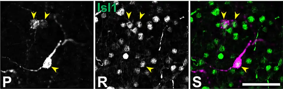 RGC fotosensibles, gran aumento, en magenta (puntas de flecha). Amácrinas en verde. Barra de escala= 50 μm. Microscopía confocal.