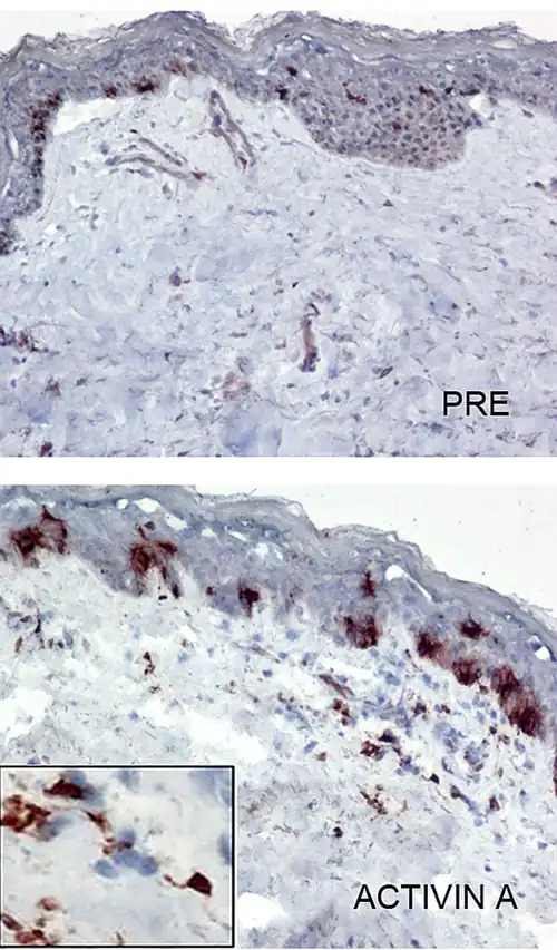 Células CL teñidas en marrón dentro de la epidermis. Microscopía óptica. Inmunohistoquímica.