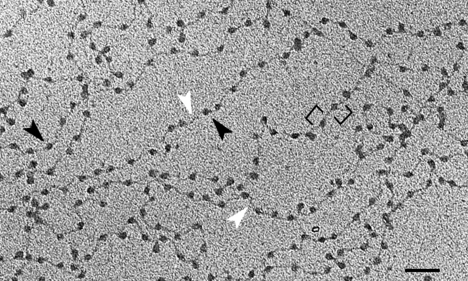 Filamentos de cromatina decondensada de eritrocitos de pollo observada al microscopio electrónico. El encadenamiento de las partículas del nucleosoma (flechas negras) separados por las hebras de ADN de conexión (puntas blancas) ha valido a esta estructura su sobrenombre de «collar de perlas». (Escala: barra= 50&nbsp;nm.