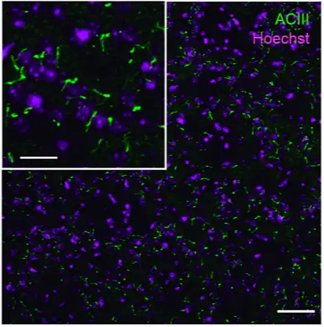 Cilias Primarias (en verde), en neuronas del striatum del cerebro.