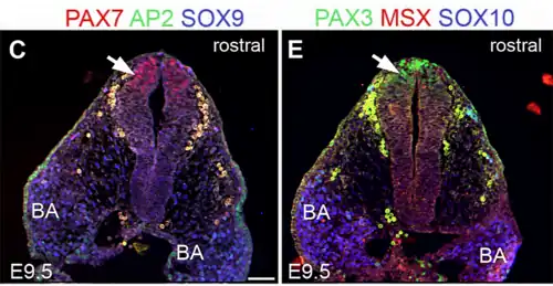 Células marcadas para genes Pax en rojo.
