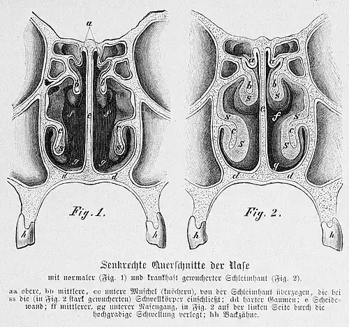 alt=Fosas nasales, corte transversal e= Pared medial o Tabique nasal. a b c= Cornetes nasales