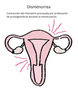 Contracción del miometrio