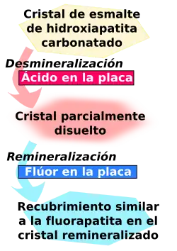 El cristal del esmalte de hydroxyapatita carbonatada es desmineralizado por el ácido en la plaqueta y se convierte en un cristal parcialmente disuelto. A su vez, éste es remineralizado por el fluoruro en la placa para convertirse en un revestimiento similar a la fluorapatita en el cristal remineralizado.