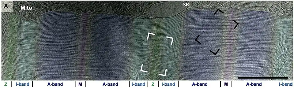 alt=Sarcómeros: se observan 2 sarcómeros entre 3 líneas Z que son parte de una Miofibrilla. Barra de escala= 1 micrómetro (μm).