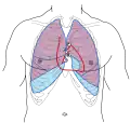 La parte delantera del tórax, mostrando relaciones de superficie de hueso, pulmones. (púrpura), pleura (azul), y corazón (contorno rojo). Están etiquetadas con Bicúspide, Tricúspide, Aórtica, y Pulmonar.