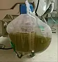 Orina verdosa durante una infusión prolongada de propofol.
