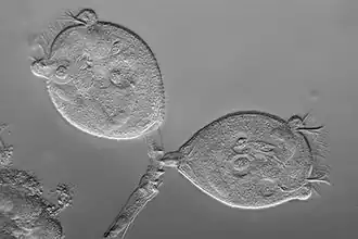 Vorticella (Sessilida)