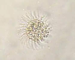 Myrionecta rubra (Cyclotrichida)