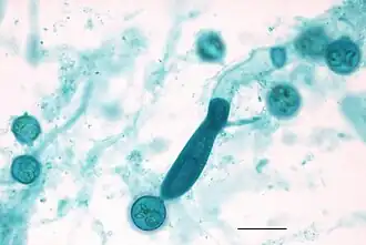 Saprolegnia (Saprolegniales)