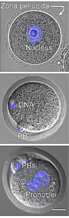 Óvulo en Metafase II. PB=cuerpo polar DNA= Pronúcleo. Microscopía de contraste de interferencia diferencial.