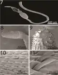 Scanning electron microscopy of Neoandracantha peruensis