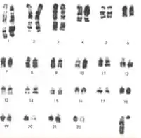 Cariotipo Muntiacus reevesi China.