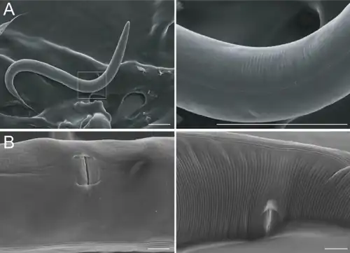 Cutícula de C. elegans: derecha anillos transversales y cordones longitudinales. Microscopio electrónico de barrido.