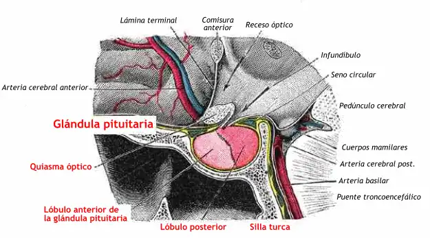Hipófisis (Glándula pituitaria), en dos tonos de rojo ("Lóbulo anterior") y ("Lóbulo posterior " ) dentro de la Silla turca. Duramadre en amarillo, formando la "tienda hipofisaria".