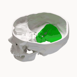 Animación (en verde).