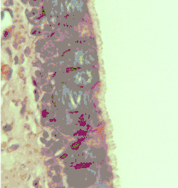 epitelio pseudoestratificado