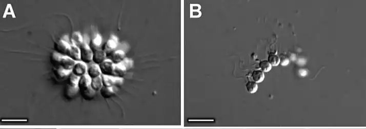 Tipos de colonias: A= roseta y B= cadena. Microscopio de interferencia.