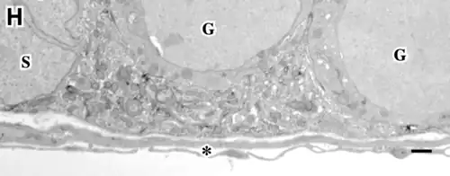 Citoplasma de la Célula de Sertoli (centro), S= núcleo. G= Espermatogonias (arriba) Microscopio electrónico
