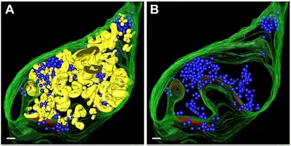 A) Botón sináptico con su contenido completo. Endosomas en amarillo. Vesículas Sinápticas (VS) en azul. Reconstrucción 3D a partir de tomogramas de microscopía electrónica.