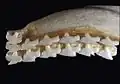 Dentadura superior