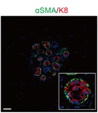 Glándula con varios acinos (arriba). Acino (abajo) con células secretoras luminales marcadas en rojo, y núcleos en azul. Células mioepiteliales teñidas en verde en la periferia del acino. Inmunofluorescencia